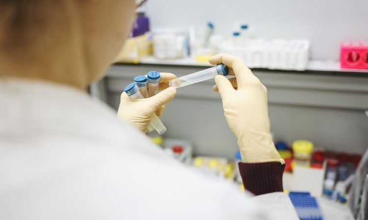 V soboto potrdili 184 okužb z novim koronavirusom