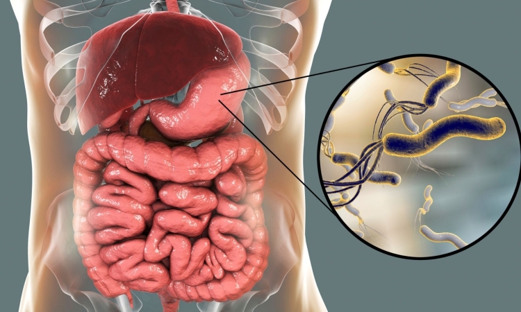 Bakterija Helicobacter pylori glavni dejavnik raka želodca v novi generaciji