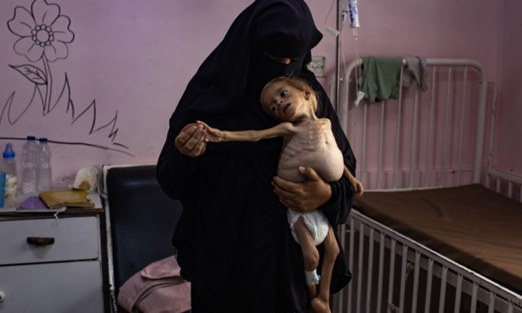 Dvoletna palestinska deklica v Gazi nujno potrebuje zdravljenje v tujini