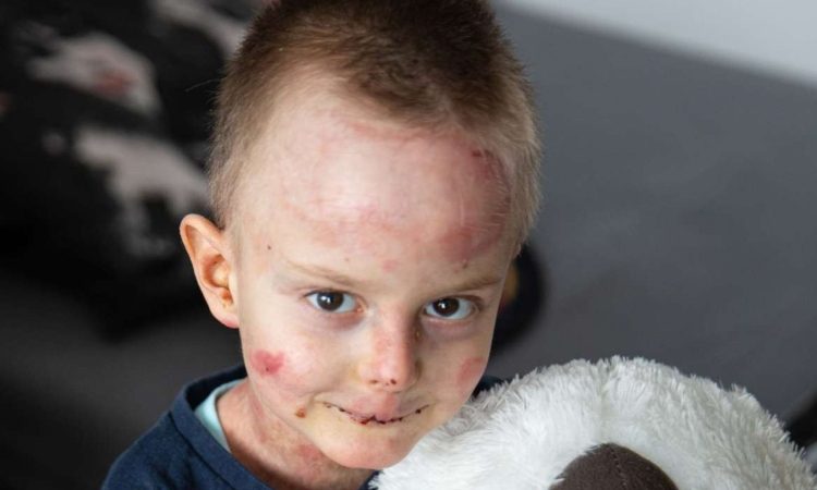 Otroci z redkimi boleznimi še naprej brez dostopa do najnovejših zdravil